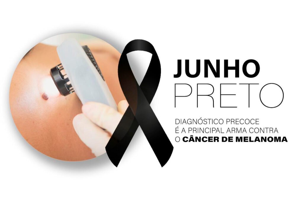 diagnostico-precoce-e-a-principal-arma-contra-o-melanoma,-tipo-mais-agressivo-de-cancer-de-pele