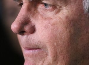 com-crise-persistente-de-solucos,-bolsonaro-faz-nova-cirurgia