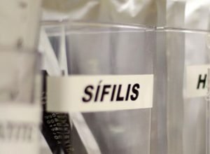centro-de-sp-tem-testagem-gratis-de-hiv,-hepatite,-siflis-e-gonorreia
